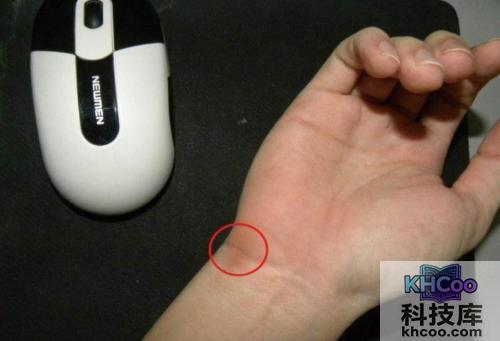 鼠标手是什么 鼠标手是什么