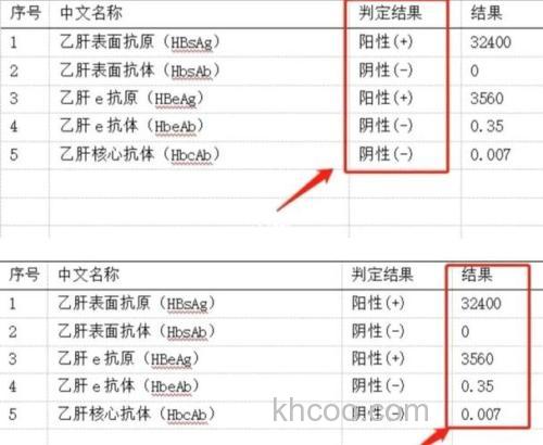 请问大家，酶量：8.21LAPU/g蛋白质以及 0.013AU/g蛋白质，这两个是什么意思？